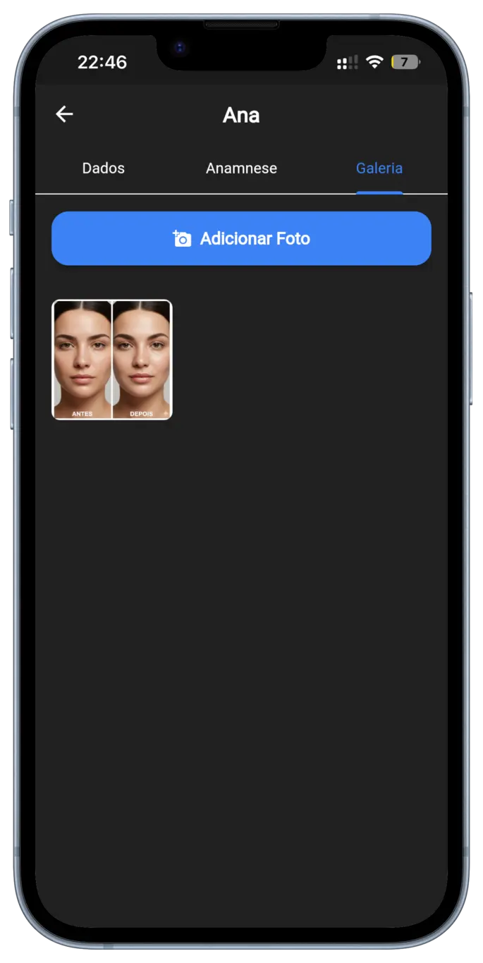 Galeria de Antes e Depois